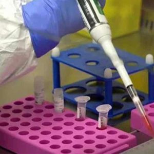 நிப்பா-வைரஸ்-–-இலங்கை-கவனம்