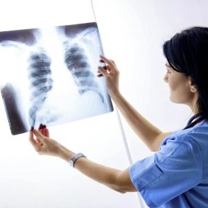 தவறான-நோயறிதல்:-நுழையீரல்-அகற்றப்பட்டது!