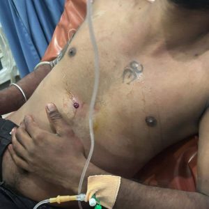 கல்-தாக்குதல்-நடக்கிறது?